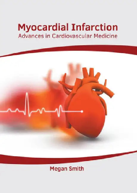 Myocardial Infarction: Advances in Cardiovascular Medicine by Megan Smith