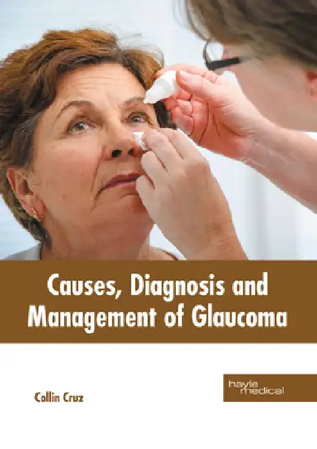 Causes, Diagnosis and Management of Glaucoma by Collin Cruz