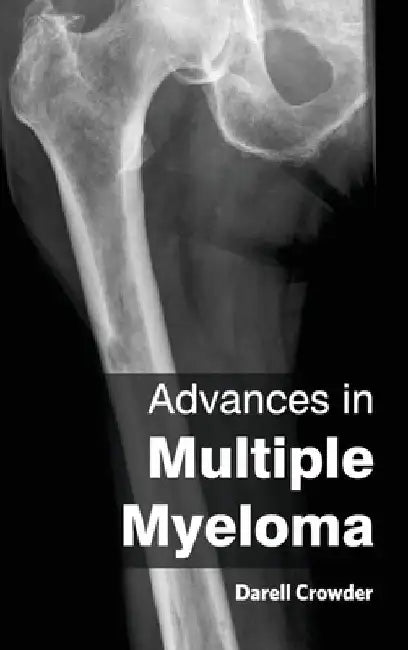 Advances in Multiple Myeloma by Darell Crowder