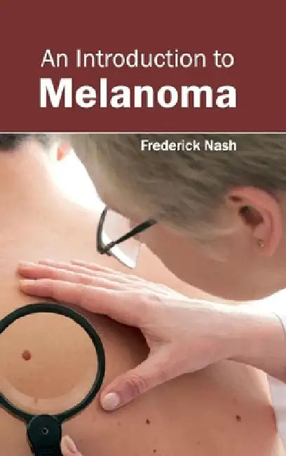 Introduction to Melanoma by Frederick Nash