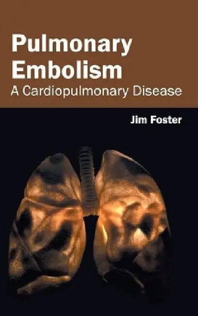 Pulmonary Embolism: A Cardiopulmonary Disease by Jim Foster