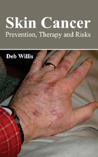 Skin Cancer: Prevention, Therapy and Risks by Deb Willis