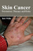 Skin Cancer: Prevention, Therapy and Risks by Deb Willis