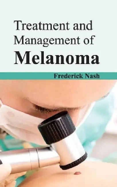 Treatment and Management of Melanoma by Frederick Nash