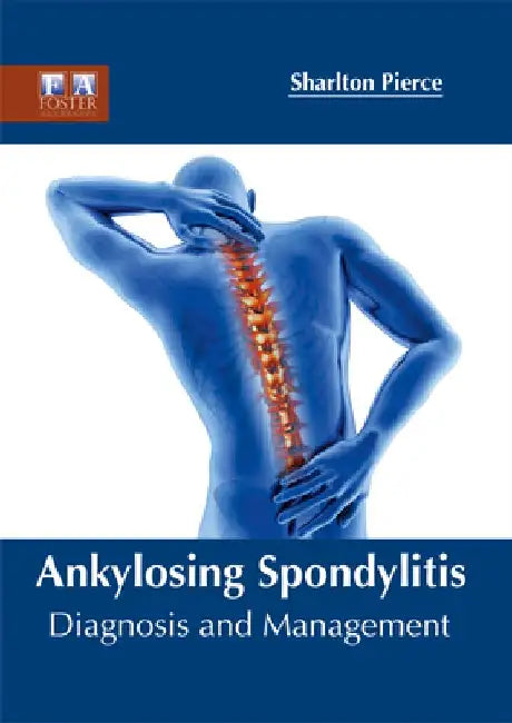 Ankylosing Spondylitis: Diagnosis and Management by Sharlton Pierce
