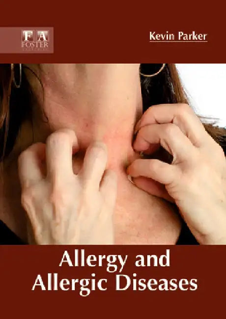 Allergy and Allergic Diseases by Kevin Parker