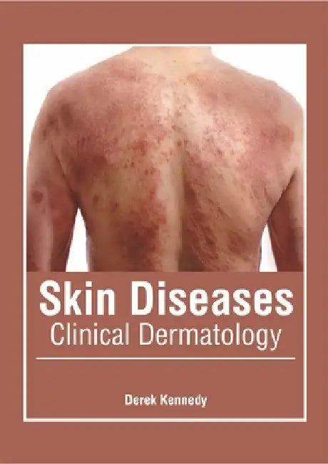 Skin Diseases: Clinical Dermatology by Derek Kennedy