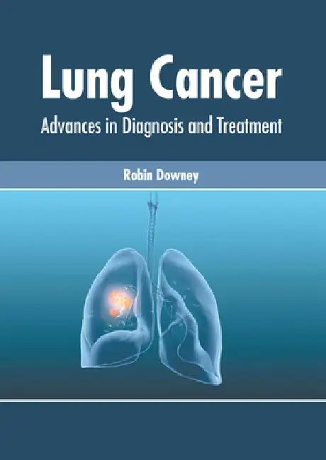 Lung Cancer: Advances in Diagnosis and Treatment by Robin Downey