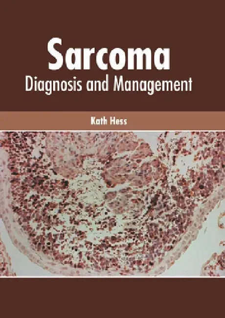 Sarcoma: Diagnosis and Management by Kath Hess
