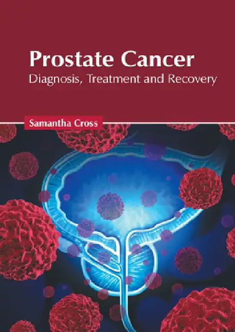 Prostate Cancer: Diagnosis, Treatment and Recovery by Samantha Cross