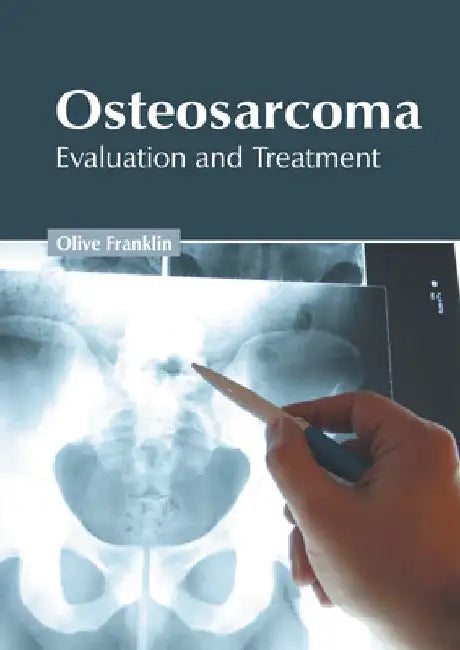 Osteosarcoma: Evaluation and Treatment by Olive Franklin