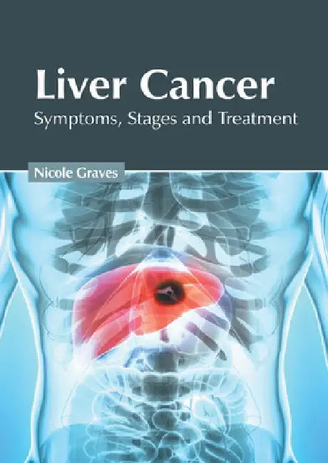 Liver Cancer: Symptoms, Stages and Treatment by Nicole Graves