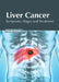 Liver Cancer: Symptoms, Stages and Treatment by Nicole Graves