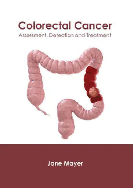 Colorectal Cancer: Assessment, Detection and Treatment by Jane Mayer