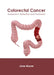 Colorectal Cancer: Assessment, Detection and Treatment by Jane Mayer