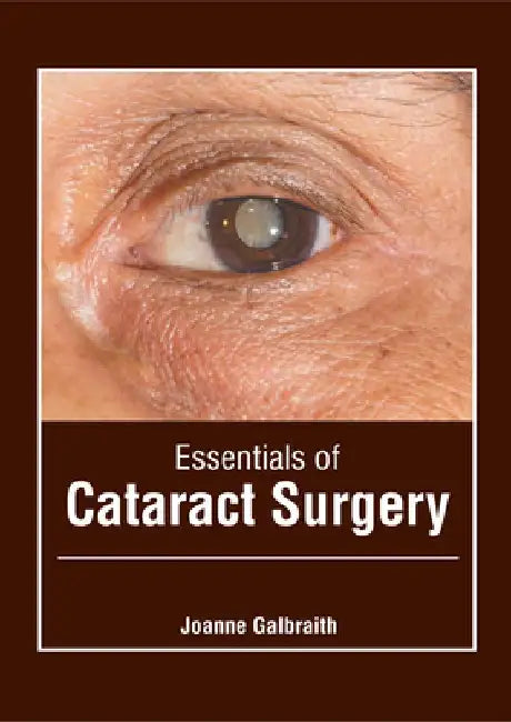 Essentials of Cataract Surgery by Joanne Galbraith