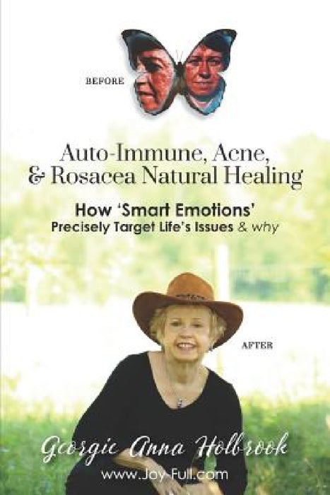 Auto-Immune, Acne, & Rosacea Natural Healing - How 'Smart Emotions' Precisely Target Life's Issues & Why by Georgie Anna Holbrook