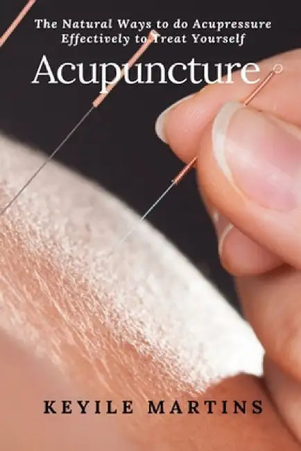Acupuncture by Keyile Martins