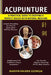 Acupuncture: A Practical Guide to Enjoying a Perfect Health with Natural Medicine by Marvin Valerie Georgia