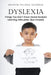 Dyslexia: Things You Don't Know About Dyslexia Learning Difficulties (But Should) by Marvin Valerie Georgia