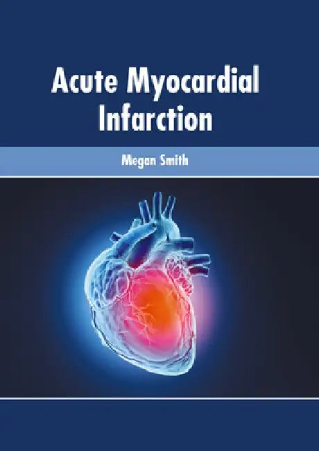 Acute Myocardial Infarction by Megan Smith