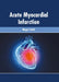 Acute Myocardial Infarction by Megan Smith