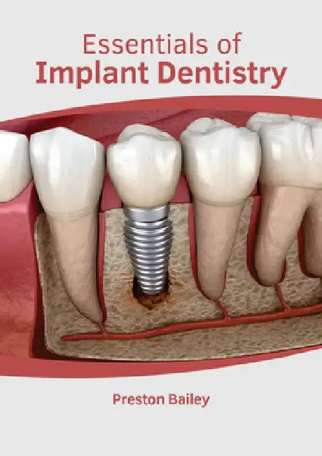 Essentials of Implant Dentistry by Preston Bailey