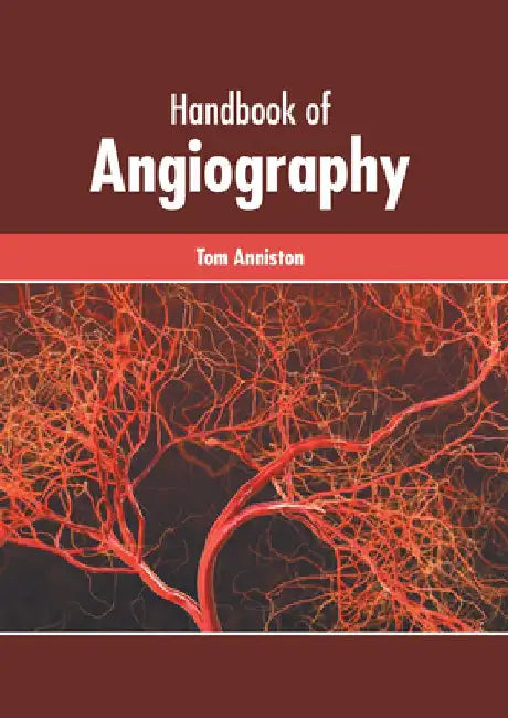 Handbook of Angiography by Tom Anniston
