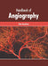 Handbook of Angiography by Tom Anniston