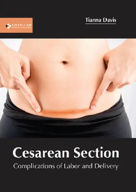 Cesarean Section: Complications of Labor and Delivery by Tianna Davis
