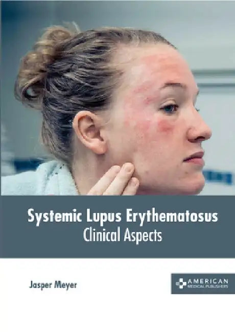 Systemic Lupus Erythematosus: Clinical Aspects by Jasper Meyer