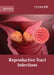 Reproductive Tract Infections by Christian Ball