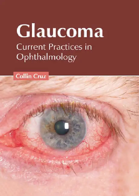 Glaucoma: Current Practices in Ophthalmology by Collin Cruz