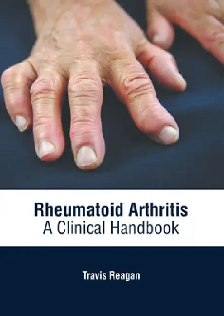 Rheumatoid Arthritis: A Clinical Handbook by Travis Reagan
