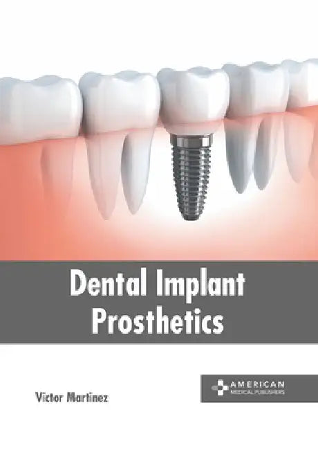 Dental Implant Prosthetics by Victor Martinez