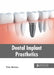 Dental Implant Prosthetics by Victor Martinez