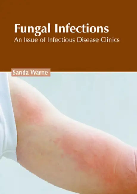 Fungal Infections: An Issue of Infectious Disease Clinics by Sanda Warne