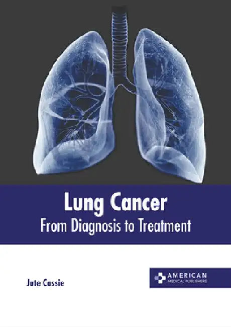 Lung Cancer: From Diagnosis to Treatment by Jute Cassie
