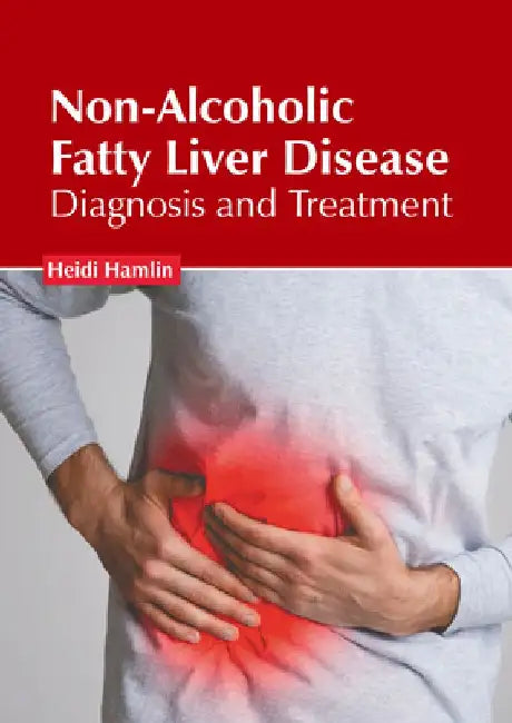 Non-Alcoholic Fatty Liver Disease: Diagnosis and Treatment by Heidi Hamlin