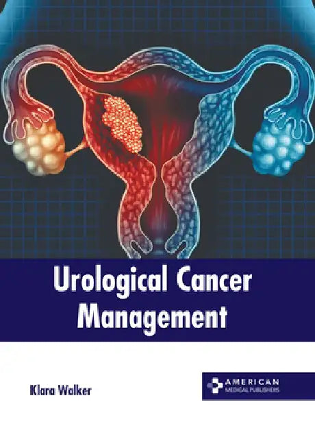 Urological Cancer Management by Klara Walker