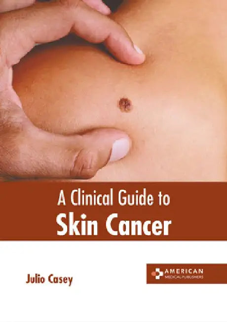 A Clinical Guide to Skin Cancer by Julio Casey