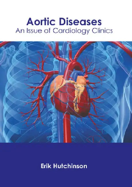 Aortic Diseases: An Issue of Cardiology Clinics by Erik Hutchinson