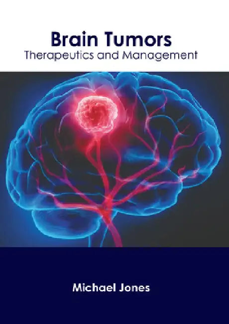 Brain Tumors: Therapeutics and Management by Michael Jones