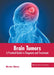 Brain Tumors: A Practical Guide to Diagnosis and Treatment by Maxton Johnson