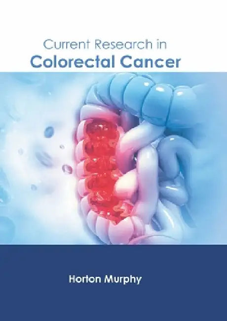 Current Research in Colorectal Cancer by Horton Murphy