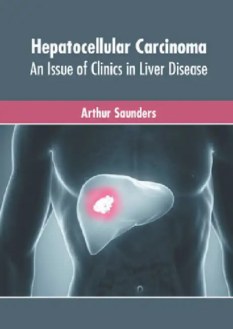 Hepatocellular Carcinoma: An Issue of Clinics in Liver Disease by Arthur Saunders