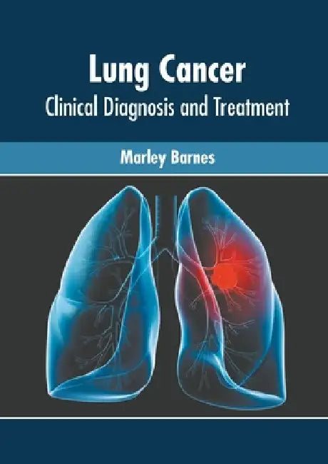 Lung Cancer: Clinical Diagnosis and Treatment by Marley Barnes