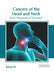 Cancers of the Head and Neck: From Diagnosis to Treatment by Bishop Hill