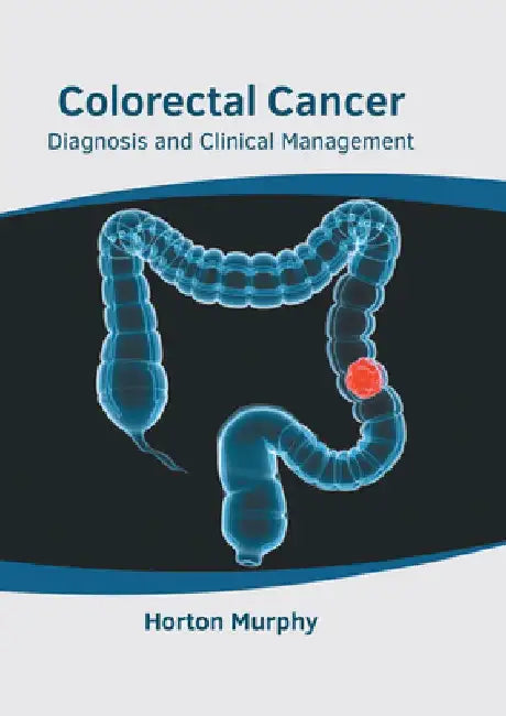 Colorectal Cancer: Diagnosis and Clinical Management by Horton Murphy