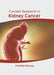 Current Research in Kidney Cancer by Frankie Harvey
